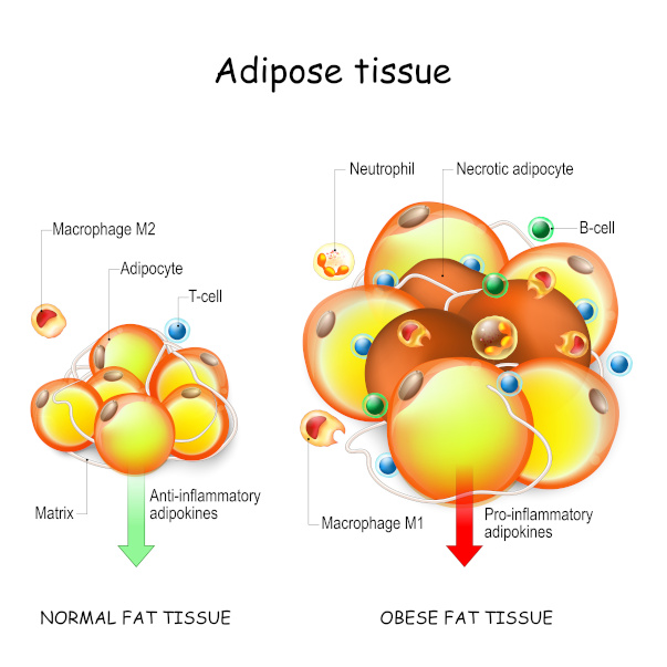 Fat loss vs weight loss : fat cell (adipocyte) clustering causing obese fat tissue