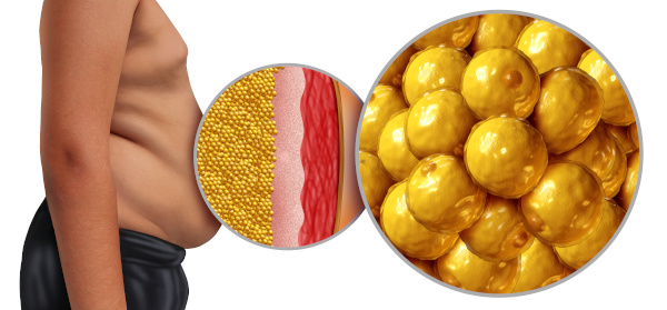weight management for men. Why losing the belly fat increases testosterone levels and metabolic health